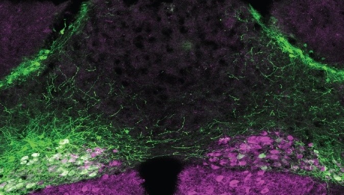 Chemogenetics image